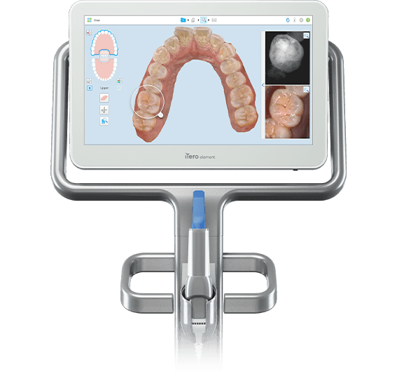 iTero Scanner
